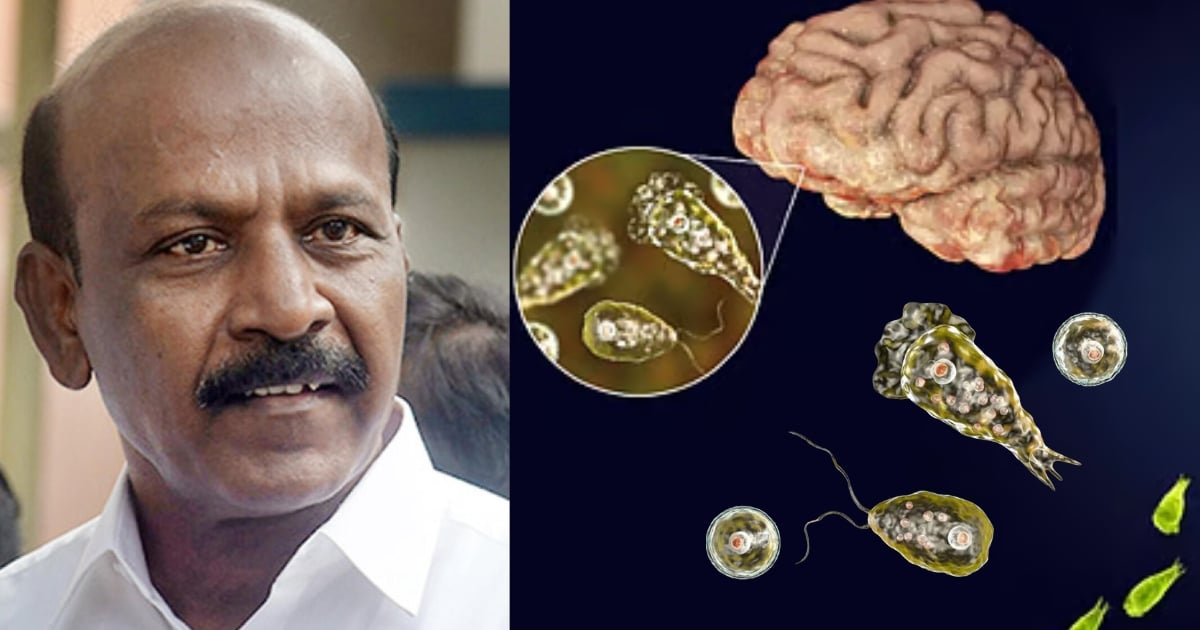 Don't panic about brain-eating amoeba disease