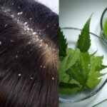 Neem Control dandruff and nourishes hair