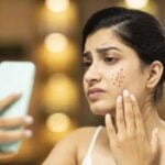 Vitamin deficiency may also cause pimples how to cure