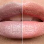 home remedies for turn dark lips pink