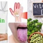  symptoms of vitamin D and B12 deficiency How to prevent