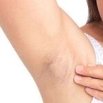 Super home remedies to remove Underarms darkness