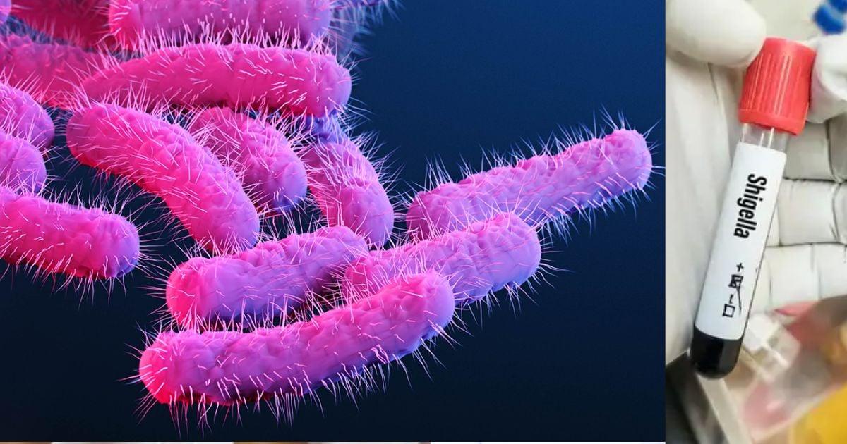 கேரளாவை அச்சுறுத்தும் ஷிகெல்லா தொற்று - Shigella infection threatens Kerala