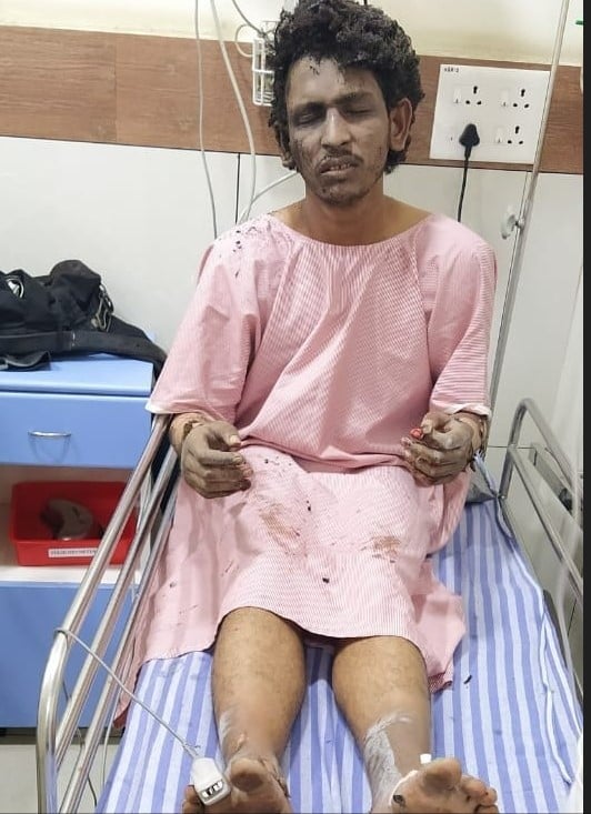mangaluru Auto blast background of injured person